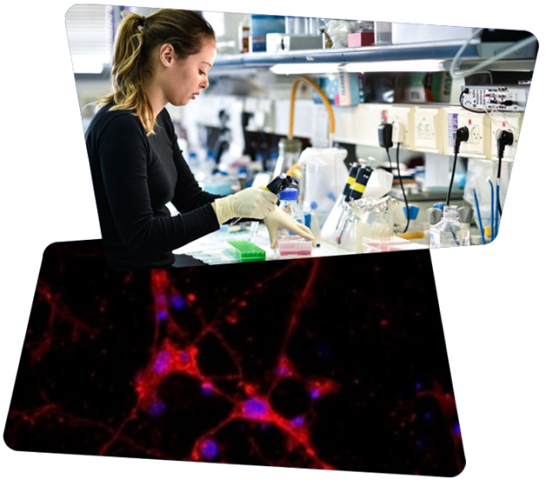 Top: Prof. Amir Orian Lab, Rappaport Faculty of Medicine, Technion-Israel Institute of Technology Bottom: Accumulation of nanoparticles in neuron cell culture (nanoparticles are red, cell nuclei are blue). All rights reserved to Prof. Avi Schroeder, Faculty of Chemical Engineering, Technion‒Israel Institute of Technology.