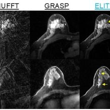 MRI ELITE, All rights reserved to the Technion- Israel Institute of Technology